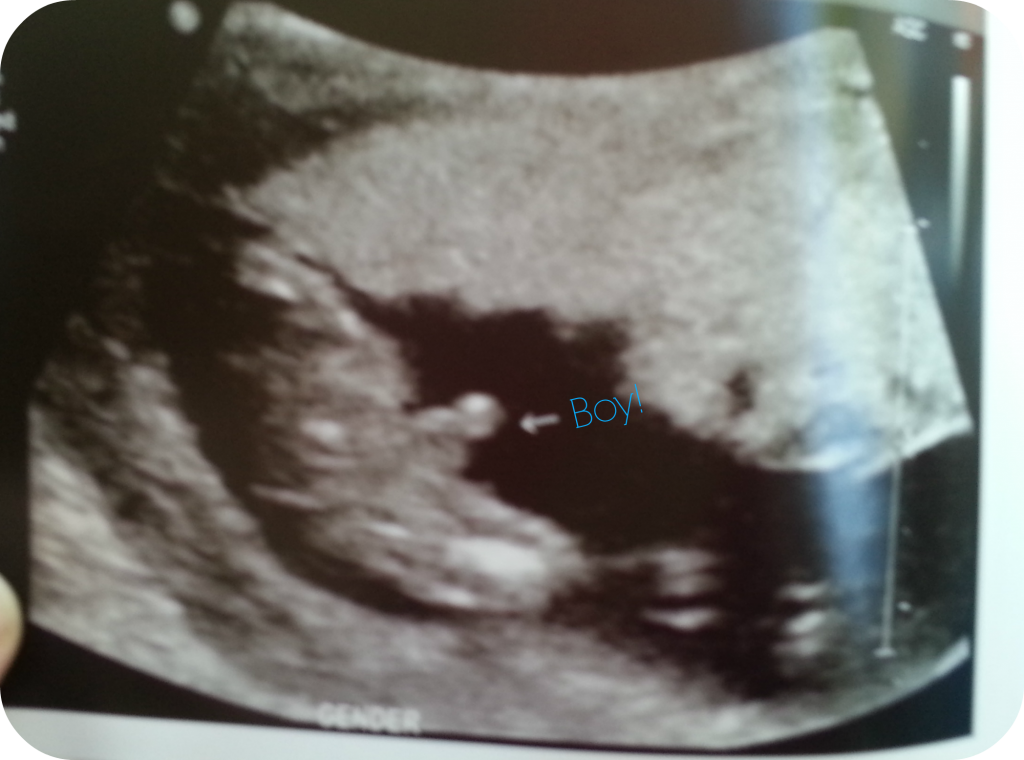 Boy Ultrasound 19 weeks